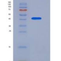 人载脂蛋白A4(APOA4)重组蛋白His Tag
