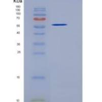 人LAP3 /细胞溶质氨肽酶重组蛋白His Tag
