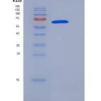 人FAM20C / DMP4重组蛋白His Tag