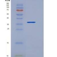 人受体活性修饰蛋白3(RAMP3)重组蛋白Fc tag
