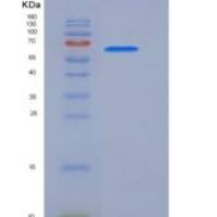 人CDC2 Kinase / CDK1重组蛋白GST tag