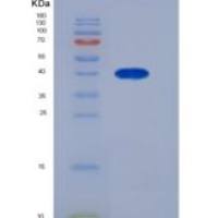 人GP1BB / CD42c重组蛋白Fc tag