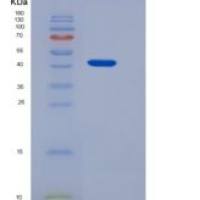 人ABHD4重组蛋白His tag