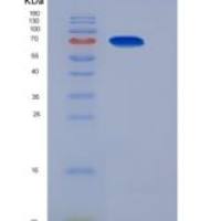 小鼠Nicastrin / NCSTN重组蛋白His tag