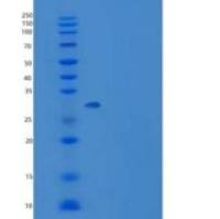 人Carbonic Anhydrase VIII / CA8重组蛋白His tag
