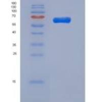 小鼠PGRL / IGSF8重组蛋白His tag