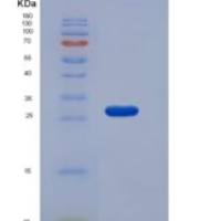 小鼠RPE / RPE2-1重组蛋白His tag