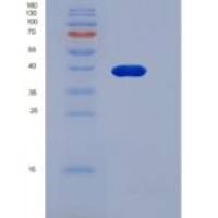 人GMPR重组蛋白His Tag
