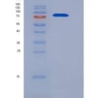 人Cbl-c / CBL-3重组蛋白His & GST tag