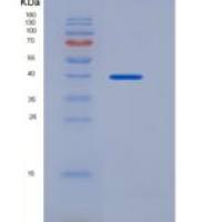 人膜联蛋白A8(ANXA8)重组蛋白His tag