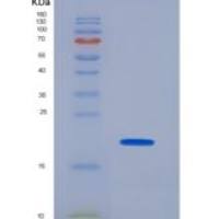 人溶菌酶G样1 / LYG1重组蛋白His tag