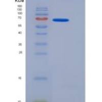 小鼠安眠蛋白1α(MEP1a)重组蛋白His tag