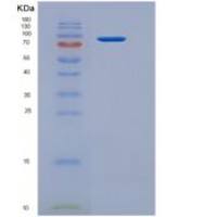 人BBOX1 / Gamma-BBH重组蛋白His & GST tag