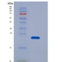 人RAC2重组蛋白His tag