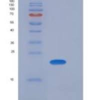 小鼠SDF2 / SDF-2重组蛋白His tag