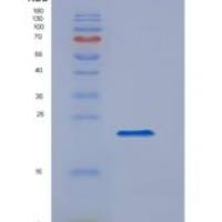 大鼠软骨凝集蛋白(CHODL)重组蛋白His tag