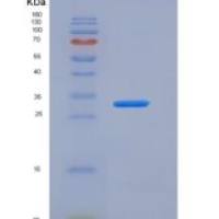 人Carbonic Anhydrase XIV / CA14重组蛋白His tag