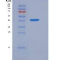 人卷曲同源物6(FZD6)重组蛋白Fc tag