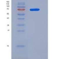 小鼠MEK1 / MAP2K1 / MKK1重组蛋白His & GST tag