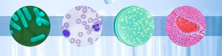 由bFGF或VEGF诱导的体内血管生成抑制剂(Thalido