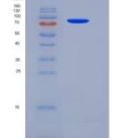 大鼠肝配蛋白A受体3(EPHA3)重组蛋白Fc tag