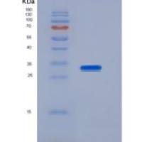 人IZUMO1重组蛋白His tag