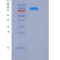 人KIAA1279重组蛋白His & GST tag