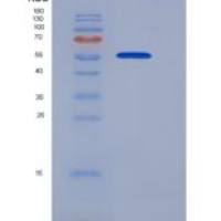 人S100A3 / S100E重组蛋白His & MBP tag