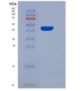 大鼠软骨凝集蛋白(CHODL)重组蛋白Fc tag