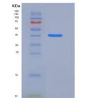 小鼠HDAC8 / HDACL1重组蛋白His tag
