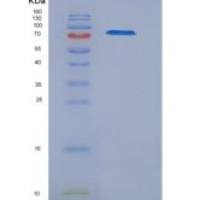 小鼠基底细胞粘附分子(BCAM)重组蛋白Fc tag