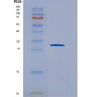 人Statherin / STATH重组蛋白Fc tag