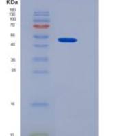 人TRAP-alpha / SSR1重组蛋白Fc tag