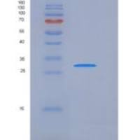 人Carbonic Anhydrase XIII / CA13重组蛋白His tag