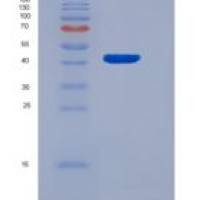 小鼠TrkB / NTRK2重组蛋白His tag