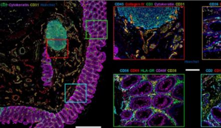 IF 60+ | PCF技术助您冲击CNS顶刊，确定不来学习一下？