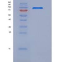 人SRPK1重组蛋白His & GST tag