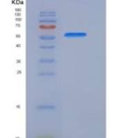 人AKT1 / PKB / PKBα重组蛋白His tag