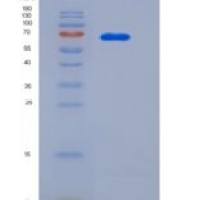 人Alpha-fetoprotein重组蛋白His Tag