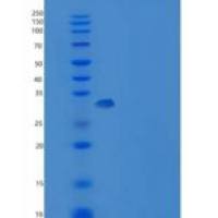 人Carbonic Anhydrase IV / CA4重组蛋白His tag
