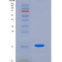 大鼠尼曼病蛋白C2(NPC2)重组蛋白His Tag