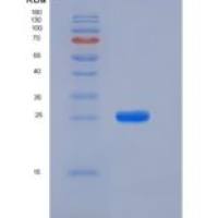 大鼠PRL8A4重组蛋白His Tag