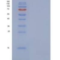 人COL6A3 / Collagen-VI重组蛋白