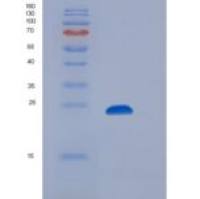 人CD32b / FCGR2B重组蛋白His & AVI tag