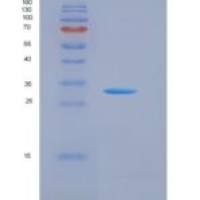 人NPC1重组蛋白His & FLAG Tag