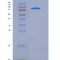 大鼠VEGFR2 / Flk-1 / CD309 / KDR重组蛋白His tag