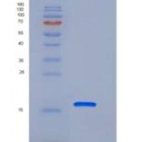 人PDZD11 / PDZK11 / PISP重组蛋白His tag