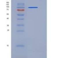 小鼠ACO2 / Aconitase 2 重组蛋白His & GST tag
