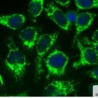 VECTASHIELD®防荧光淬灭封片剂