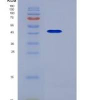 人PTX3 / Pentraxin 3 / TSG-14重组蛋白His tag